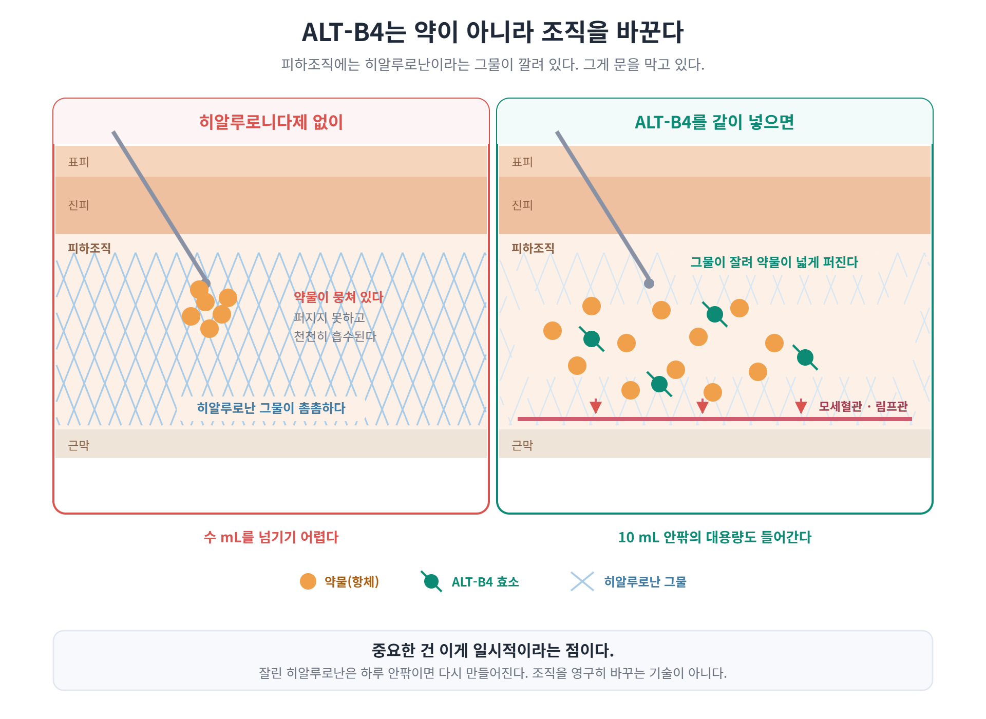 ALT-B4 히알루로니다제의 피하조직 작용 원리 — 히알루로난 그물이 잘려 약물이 넓게 퍼지는 과정